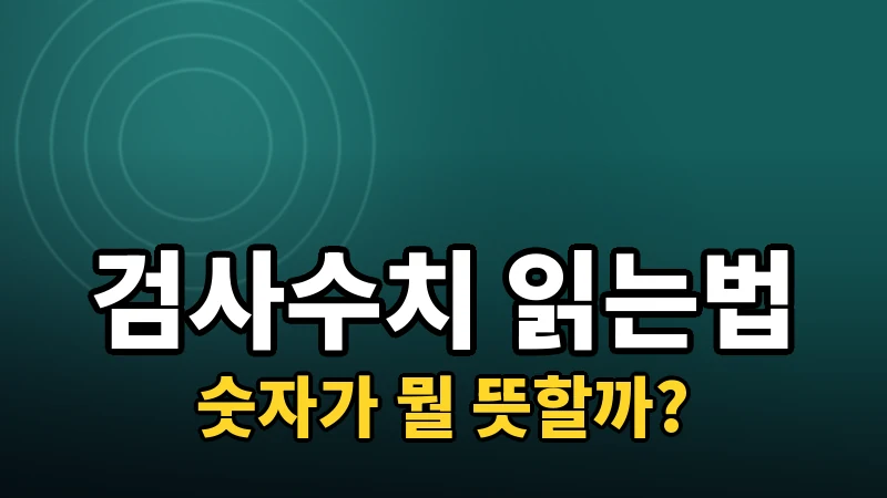 각막두께·안압 검사 수치, 소비자가 읽는 법